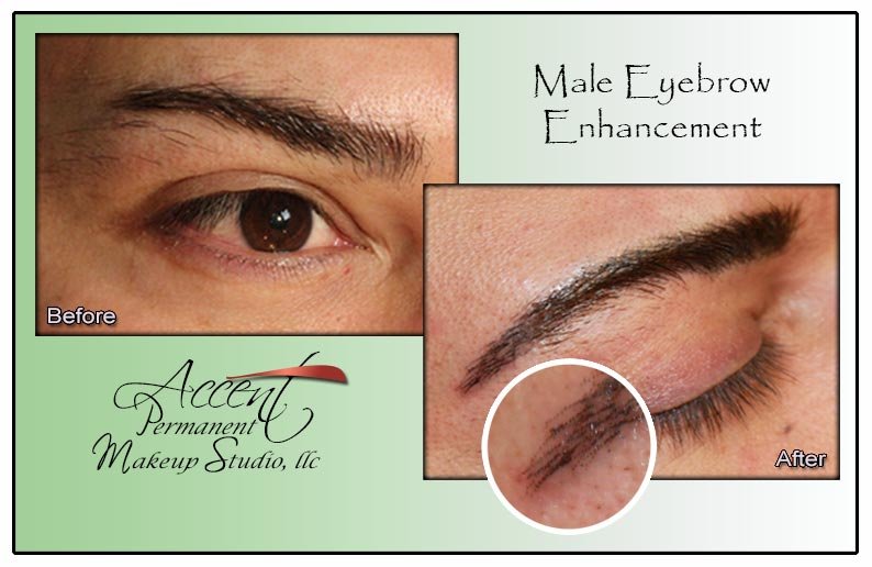 Male Brow Enhancement