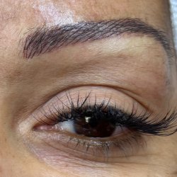 Brow Enhancement